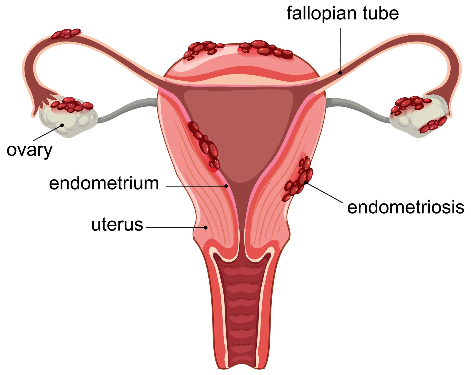Uterus-related treatments